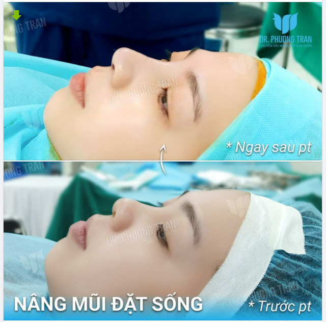 CHỈ CẦN ĐẶT SỐNG LÀ ĐỦ VỚI BẠN ẤY