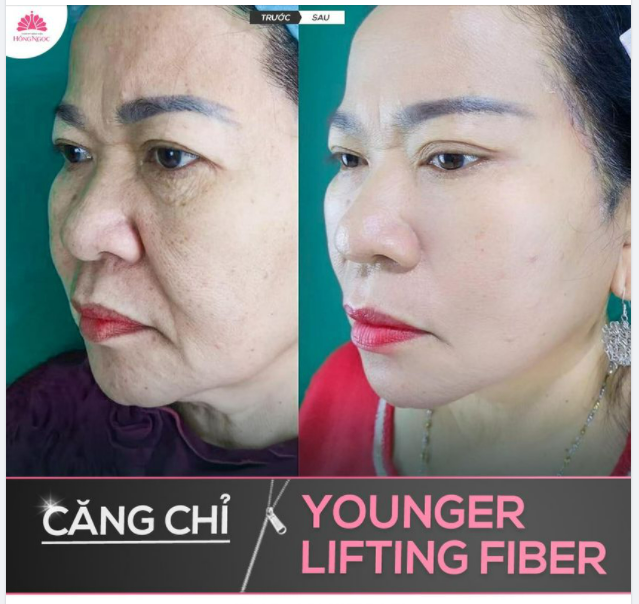 CHIA TAY ''GIÀ NUA'' - BÀ NỘI U60 ''ĐÓN'' DIỆN MẠO TƯƠI TRẺ LẠ THƯỜNG