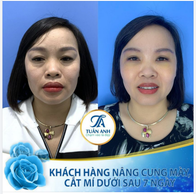 COMBO NÂNG CUNG MÀY CẮT MÍ DƯỚI - BÍ QUYẾT NÍU GIỮ THANH XUÂN