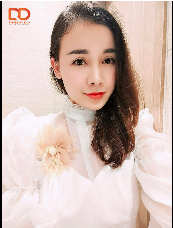 Combo Nâng mũi Cắt mí chưa bao giờ hết hot tại Thẩm mỹ DrD.