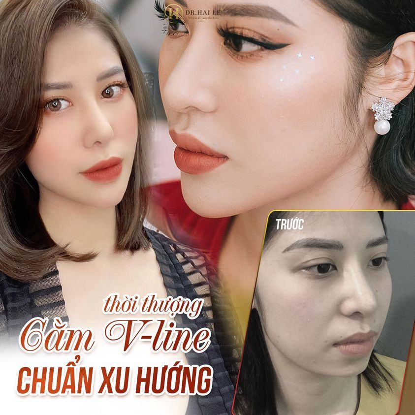 Cứ ngỡ Hotgirl nào hóa ra là khách hàng nhà Dr.Hải Lê