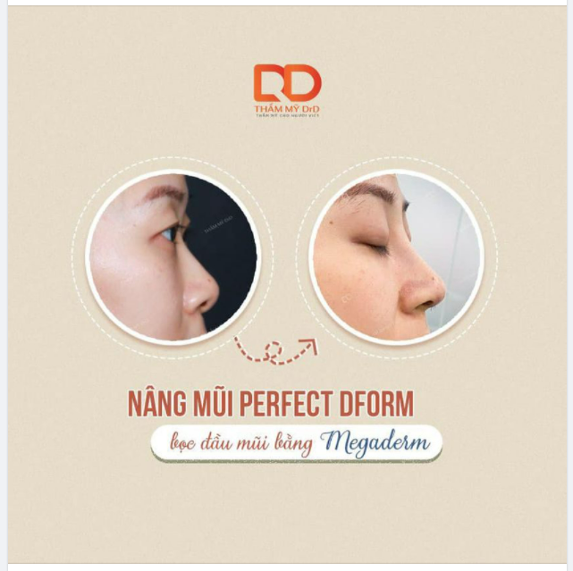 Da mũi mỏng thì nâng dáng mũi gì cho hợp?