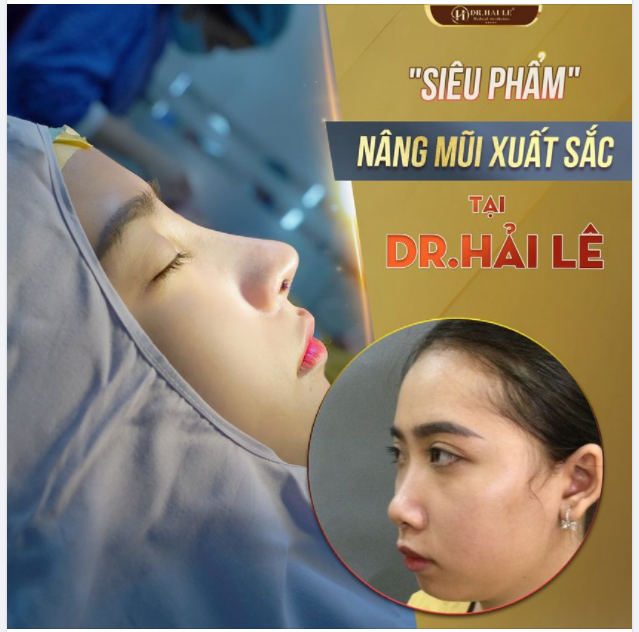 DÁNG MŨI VÀNG - DIỆN MẠO TOẢ SÁNG