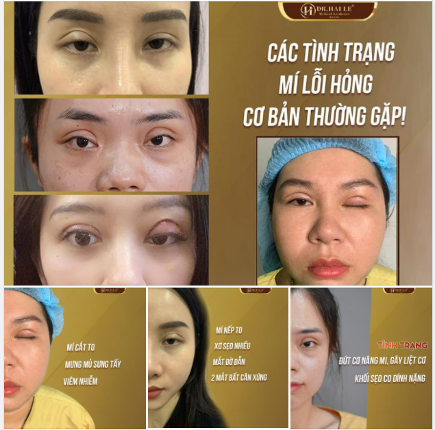 DẤU HIỆU NHẬN BIẾT MÍ LỖI, HỎNG VÀ GIẢI PHÁP KHẮC PHỤC!