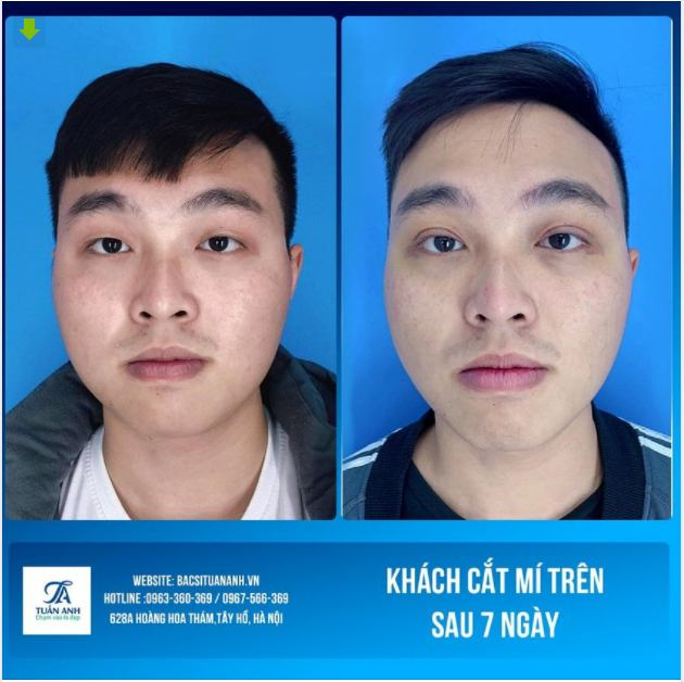 ĐÂU PHẢI CÁC CHÀNG TRAI LÀ KHÔNG CẦN QUAN TÂM TỚI THẨM MỸ KHUÔN MẶT.