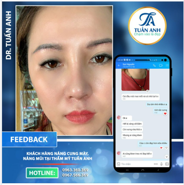 ĐÂY LÀ VẺ ĐẸP MÀ BẤY LÂU CÁC CHỊ EM MONG MUỐN