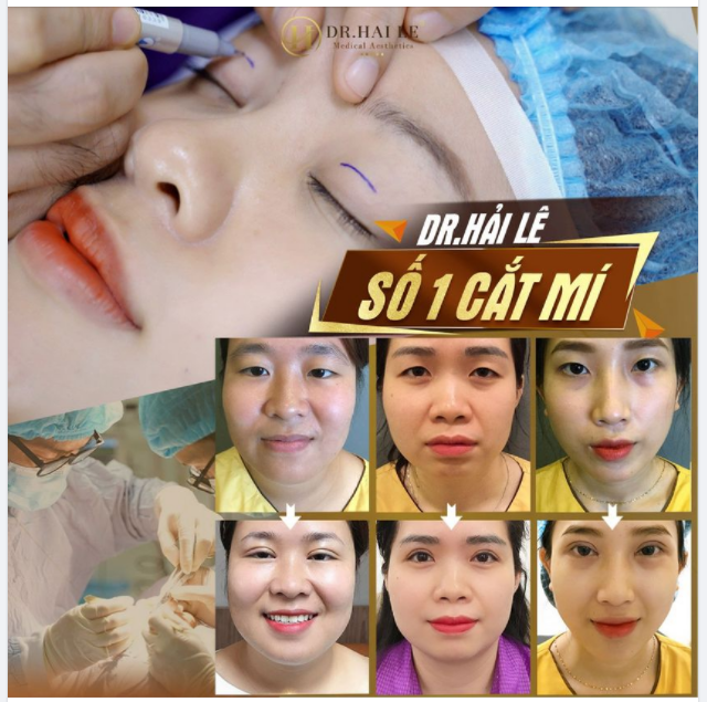 ĐỂ “THÀNH CÔNG” ĐÔI KHI PHẢI ĐI NGƯỢC “ĐÁM ĐÔNG”