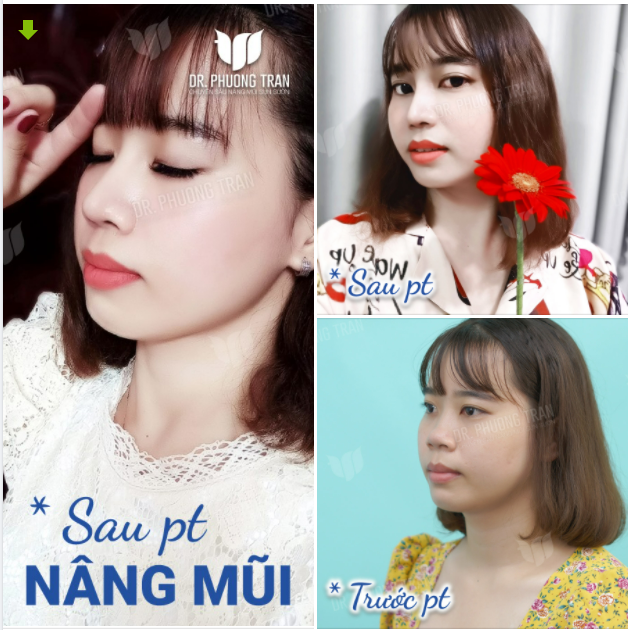 ĐẸP HAY KHÔNG LÀ DO EM CHỌN, CÔ GÁI À!