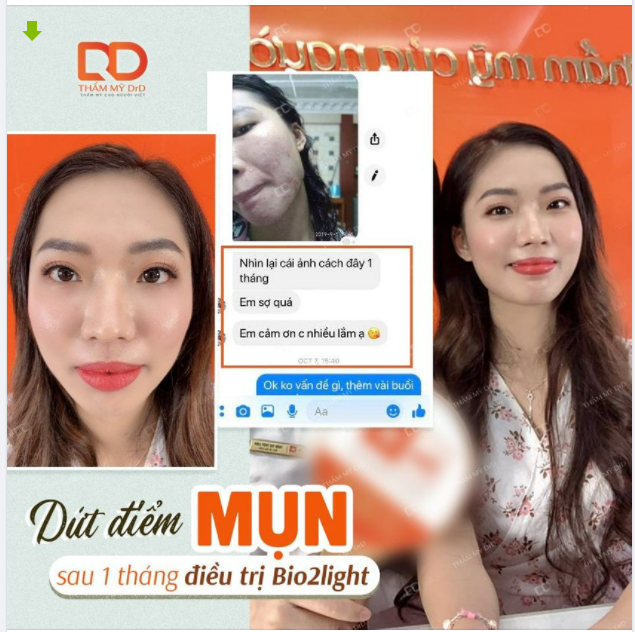 ĐIỀU TRỊ MỤN BIO2LIGHT HIỆU QUẢ CÓ THỂ RÚT NGẮN QUY TRÌNH?