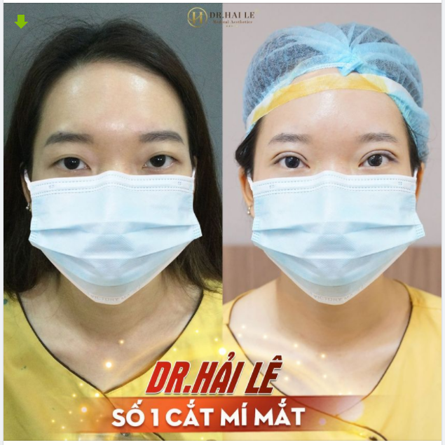 DR.HẢI LÊ 12 NĂM- THÁNG SINH NHẬT - GIÁ PHÁ ĐẢO - QUÀ BẤT TẬN