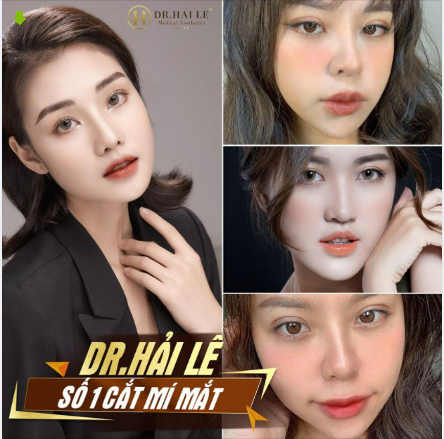 DR.HẢI LÊ SỐ 1 CẮT MÍ MẮT.!