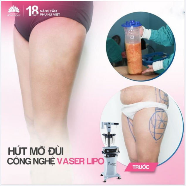 ĐÙI TO KHÔNG CÒN LÀ NỖI LO