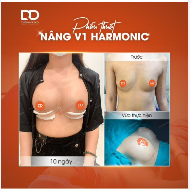 Đúng người, đúng thời điểm thì hạnh phúc. Đúng size ngực, đúng chất liệu... là hình ảnh dưới đây.