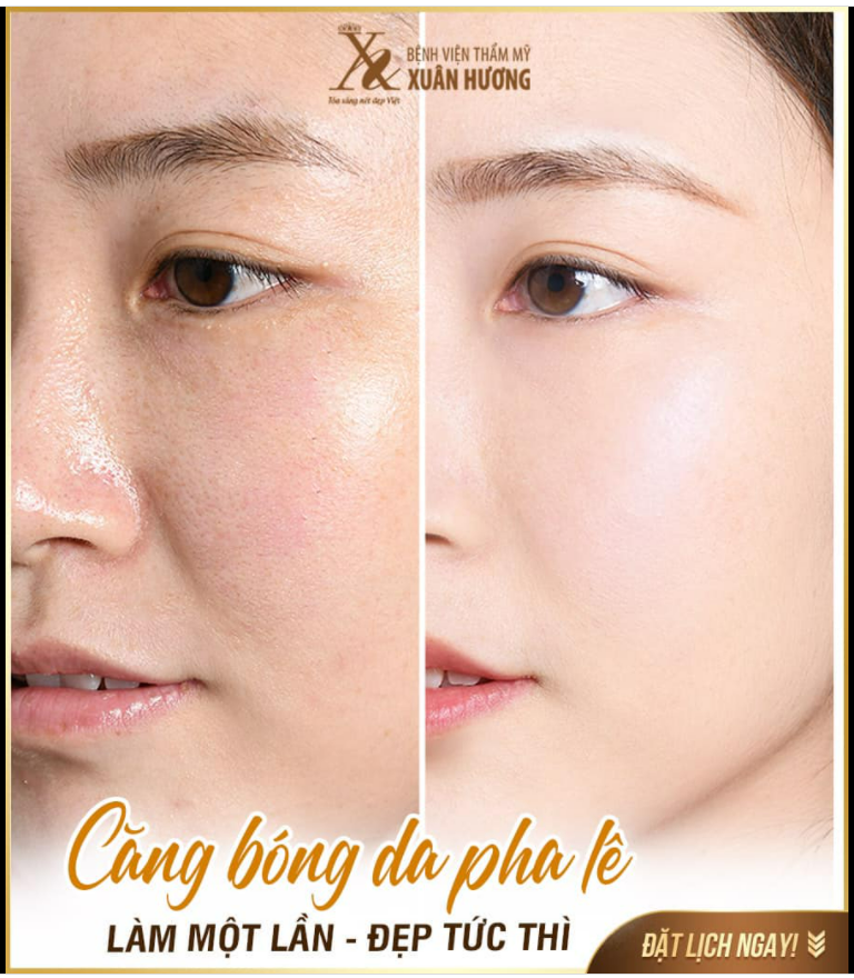 GIẢI PHÁP HỒI SINH DA XUỐNG CẤP CHỈ 1 LẦN DUY NHẤT - THẤY NGAY DA CĂNG BÓNG MƯỚT MỊN