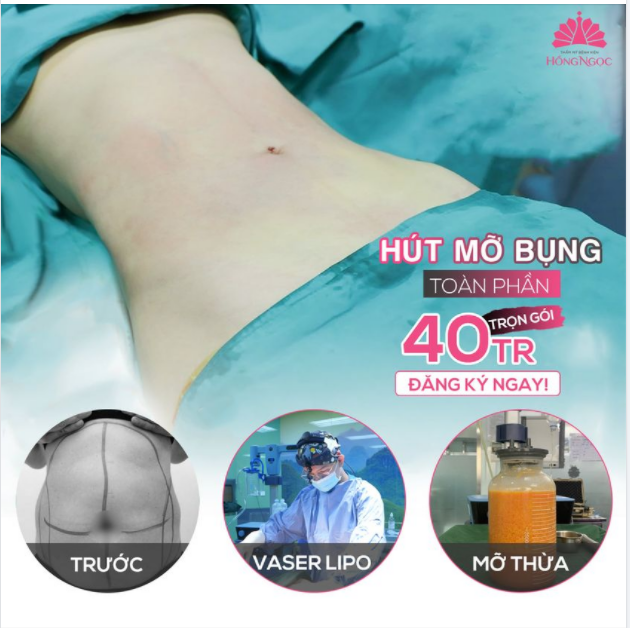 GIẢM MỠ THẦN TỐC - PHÚT CHỐC EO THON