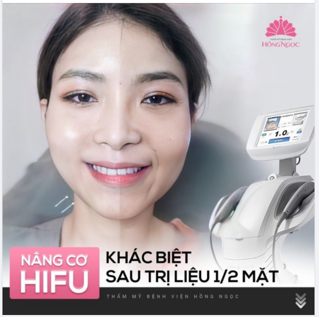 GÓC KIỂM CHỨNG SỰ KHÁC BIỆT 1/2 GƯƠNG MẶT CỦA CHỊ HOA SAU KHI NÂNG CƠ HIFU