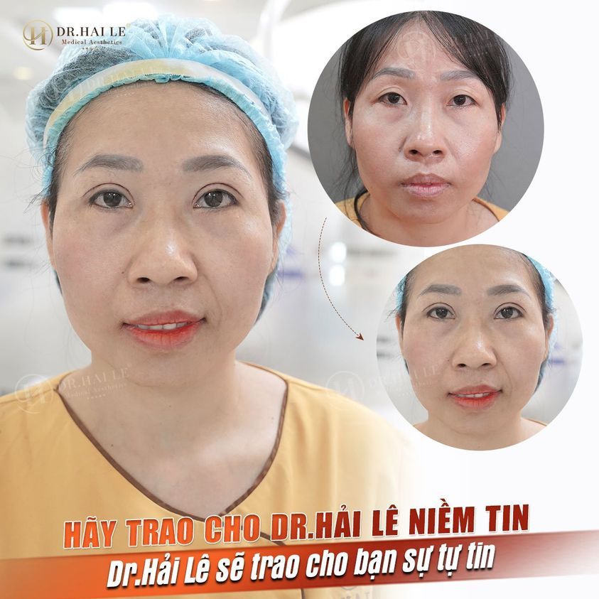 HÀNH TRÌNH THAY ĐỔI, THAM GIA GIẢI CỨU MÍ HỎNG MÙA 2!