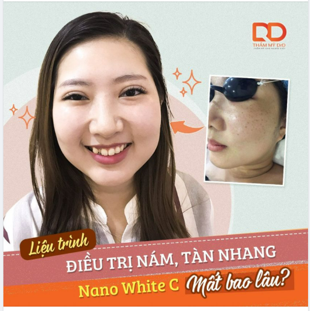 Hãy tạm biệt các phương pháp điều trị nám, tàn nhang thông thường đi.