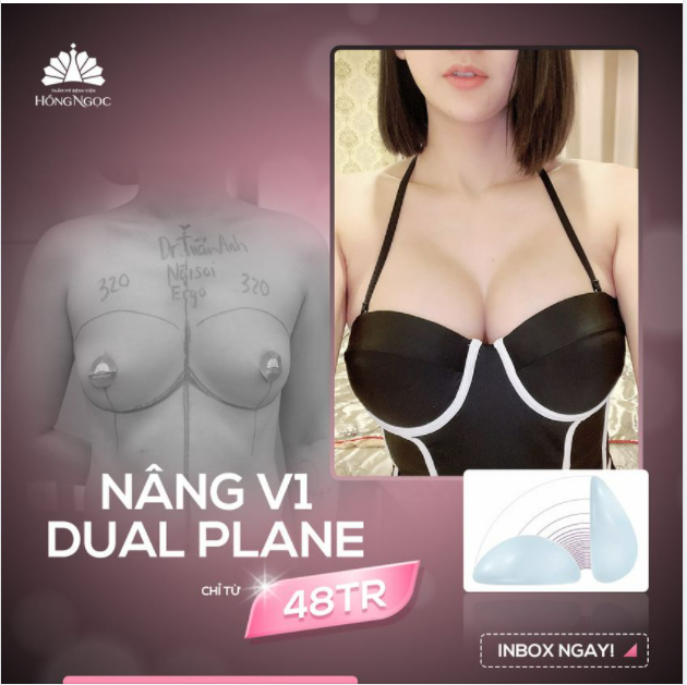 HÔ BIẾN V1 HÉO HON THÀNH BƯỞI CĂNG TRÒN