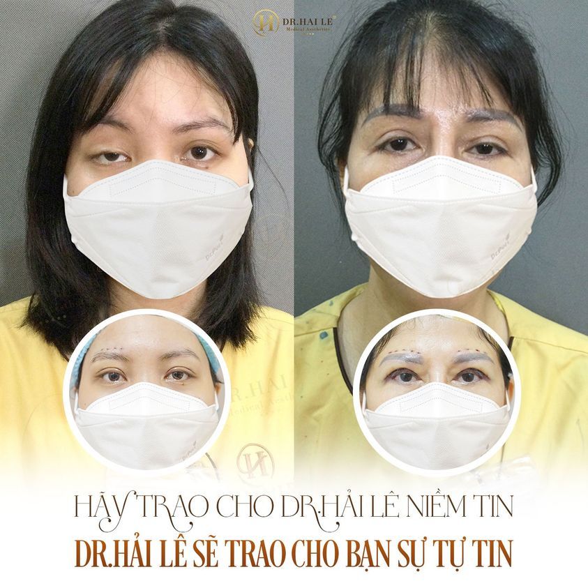 "HỒI SINH" MÍ HỎNG TẠI DR.HẢI LÊ !