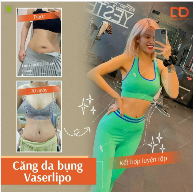 HÚT MỠ RỒI CÓ ĐƯỢC ĂN UỐNG "THẢ PHANH"?