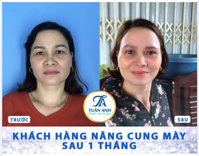 Kết quả của khách hàng sau nâng cung mày 1 tháng