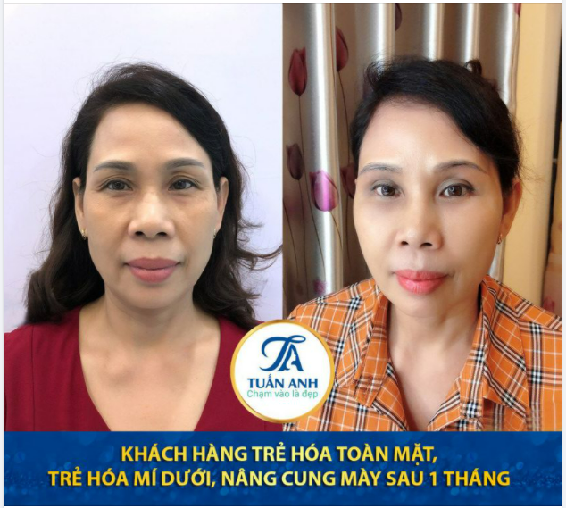 Kết quả sau 1 tháng khách hàng trải nghiệm combo 3 dịch vụ