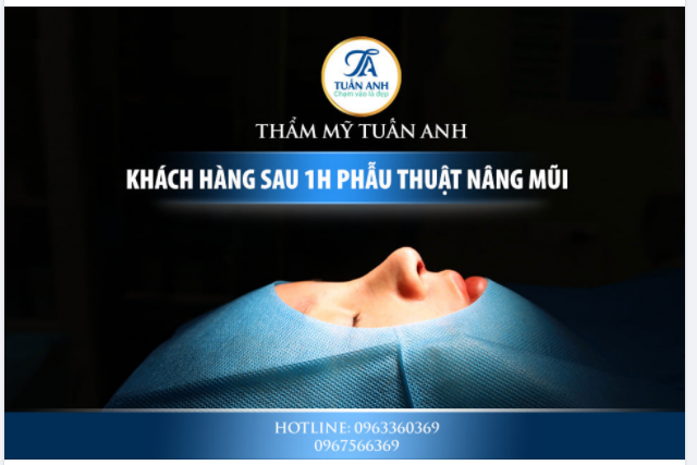 Kết quả sau 60’ trải nghiệm dịch vụ NÂNG MŨI BÁN CẤU TRÚC của Dr Tuấn Anh.