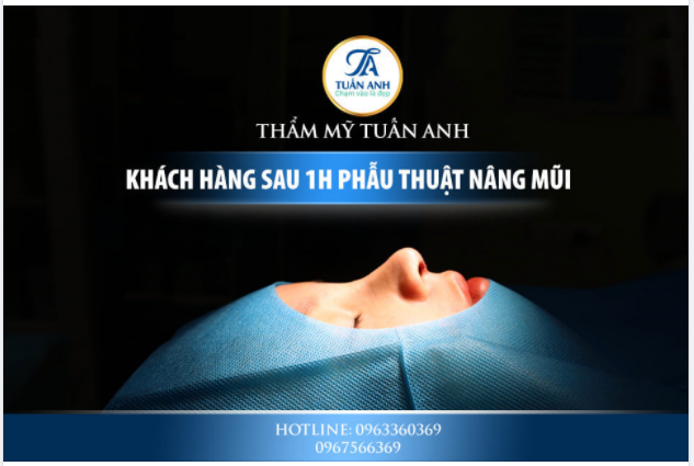 Kết quả sau 60’ trải nghiệm dịch vụ NÂNG MŨI BÁN CẤU TRÚC của Dr Tuấn Anh.
