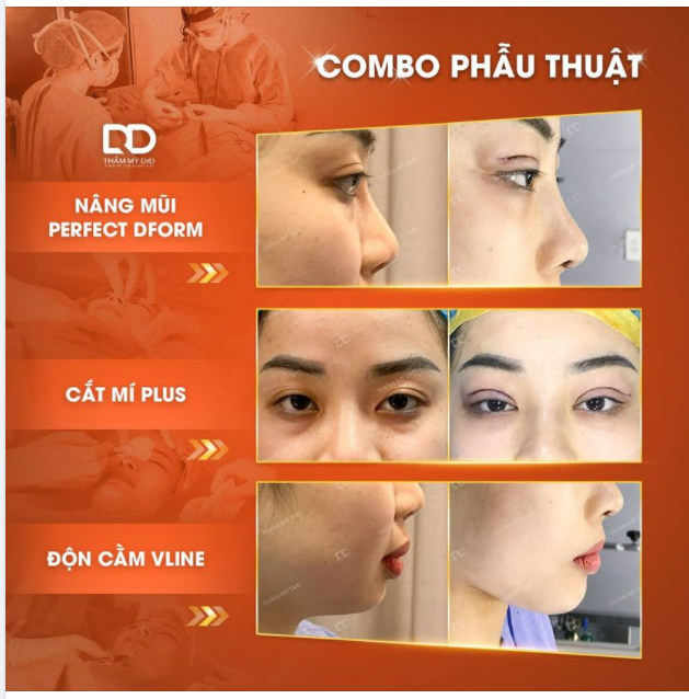 Không làm combo, "đời" không đẹp. Bộ 3 dịch vụ, 1 khách hàng thực hiện lại tiếp tục "lên sóng".