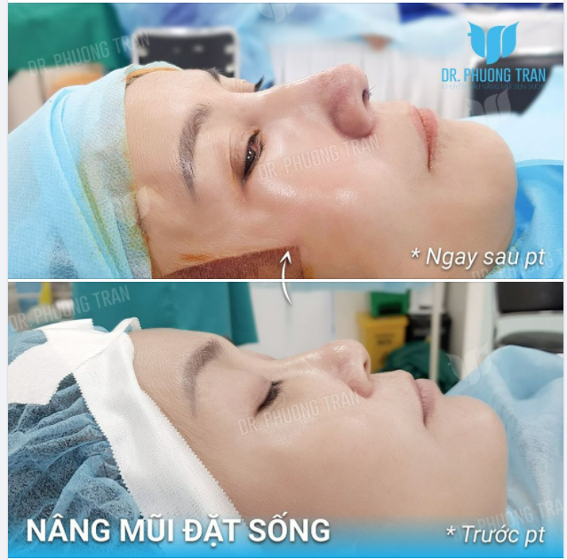 ”KHÔNG PHẢI KHÁC MÀ LÀ QUÁ KHÁC”