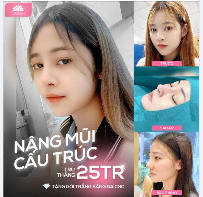LÀM 1 ĐẸP 2 KHÔNG NGẠI CHI PHÍ