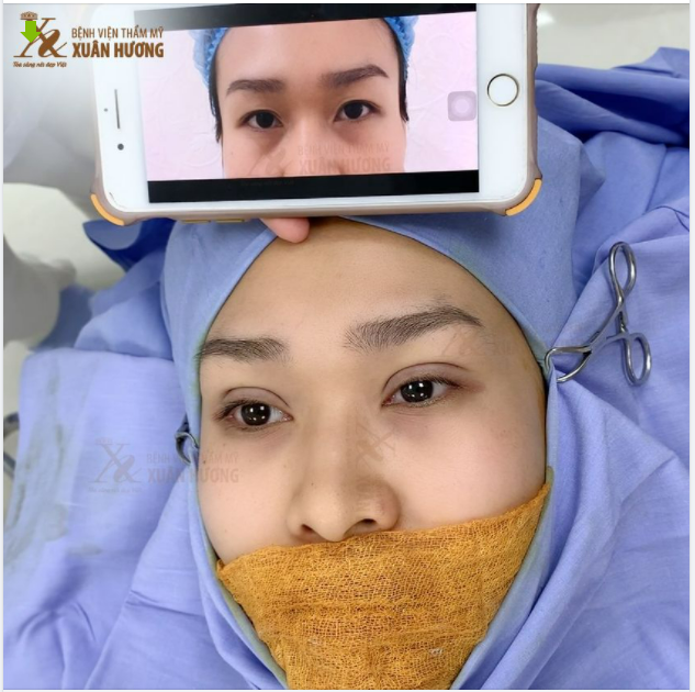 LỰA CHỌN TỈ LỆ NẾP MÍ TỐI ƯU CHO KHÁCH HÀNG