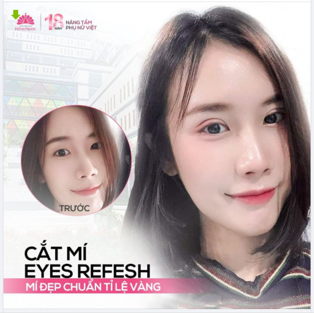 MẮT ĐẸP TỰ NHIÊN NHƯNG KHÔNG TỰ NHIÊN MÀ ĐẸP