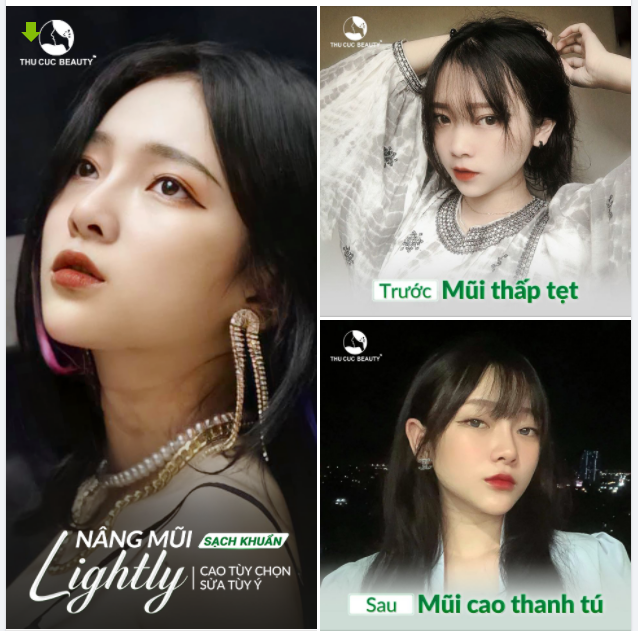 MÊ ĐẮM DÁNG MŨI CAO THANH TÚ CỦA KH THU CÚC