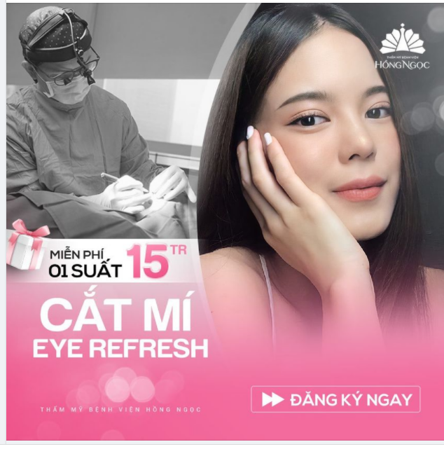 MIỄN PHÍ CẮT MÍ EYE REFRESH TRỊ GIÁ 15TR