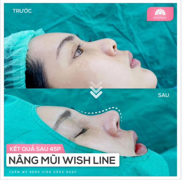 MỘT GÓC NGHIÊNG - HAI SỐ PHẬN