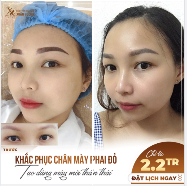 MỰC CHÂN MÀY BỊ PHAI ĐỎ, CÓ CÁCH NÀO ĐỂ KHẮC PHỤC?