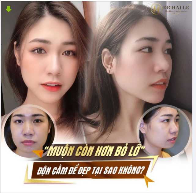 “MUỘN CÒN HƠN BỎ LỠ” - ĐỘN CẰM ĐỂ ĐẸP TẠI SAO KHÔNG