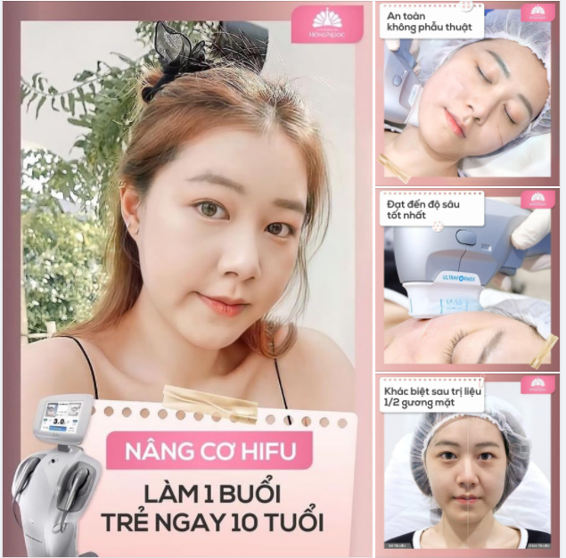NÂNG CƠ HIFU 1 BUỔI - TRẺ RA 10 TUỔI LÀ CÓ THẬT!