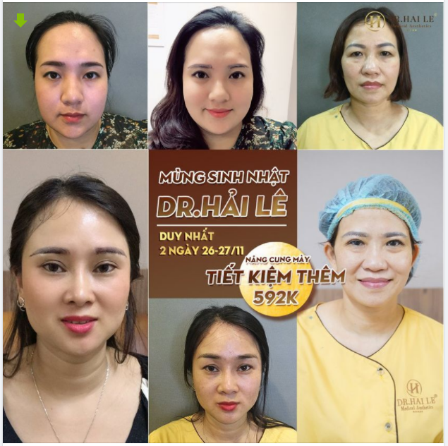 NÂNG CUNG MÀY HẾT NHĂN ĐUÔI MẮT​​​​​​​ HẾT SỤP MÍ TRẺ HÓA MẮT ĐẾN 10 TUỔI
