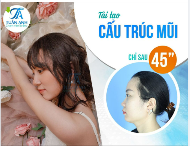 NÂNG MŨI CẤU TRÚC - THU HÚT TÀI LỘC CHỈ VỚI 45 PHÚT TẠI THẨM MỸ TUẤN ANH