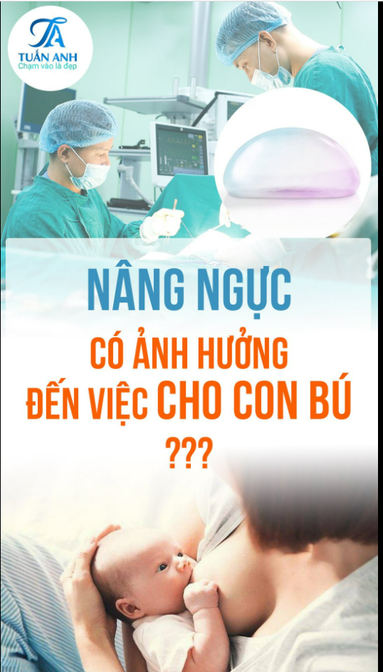NÂNG NGỰC CÓ ẢNH HƯỞNG ĐẾN VIỆC CHO CON BÚ KHÔNG