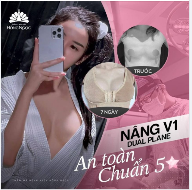 NÂNG V1 DUAL PLANE: AN TOÀN - CHUẨN 5 SAO