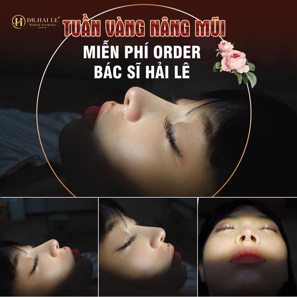 Nếu bạn đang băn khoăn về chi phí nâng mũi thẩm mỹ thì bài viết này đích thị dành cho bạn!