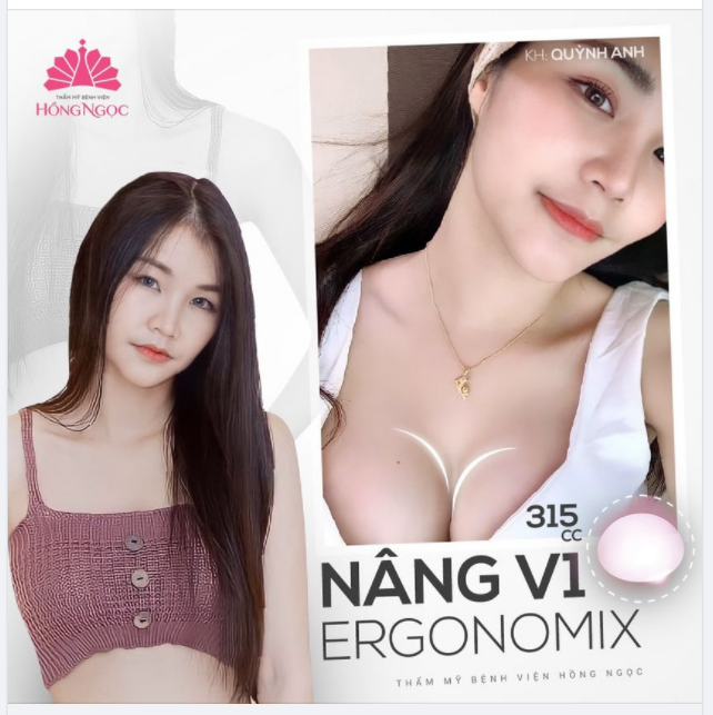 NGẮM NHÌN SIÊU PHẨM V1 NHÌN LÀ ''ĐẮM'' - NGẮM LÀ ''MÊ'' CỦA QUỲNH ANH SAU 2 THÁNG NÂNG CẤP