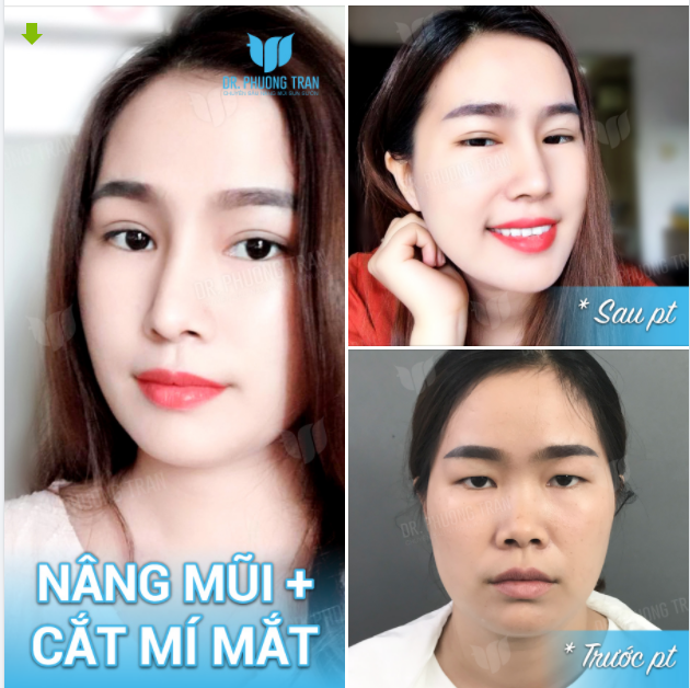 Ngoài trời đang yên ắng bỗng chốc đổ cơn mưa
