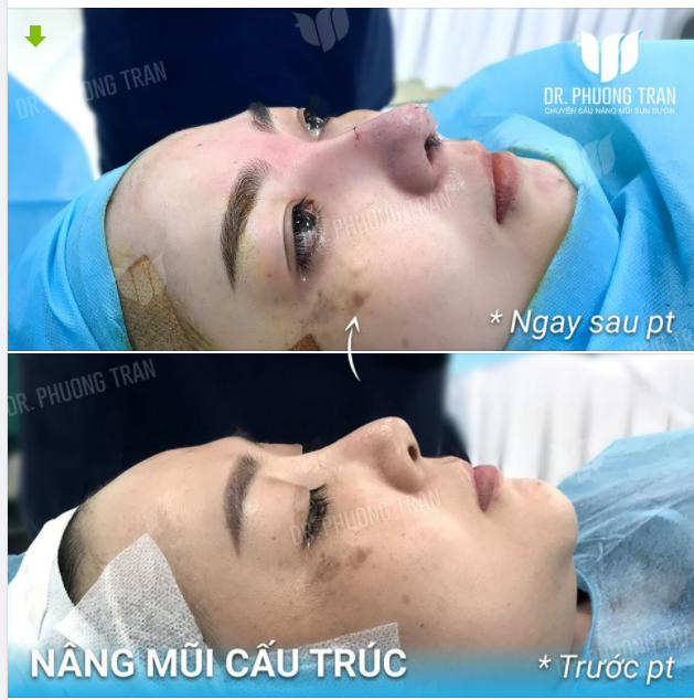 Người ta ngây ngất trước sự hào nhoáng, mê mẩn trước sự bóng bẩy, nhưng chỉ rơi nước mắt trước sự giản dị tự đáy lòng.
