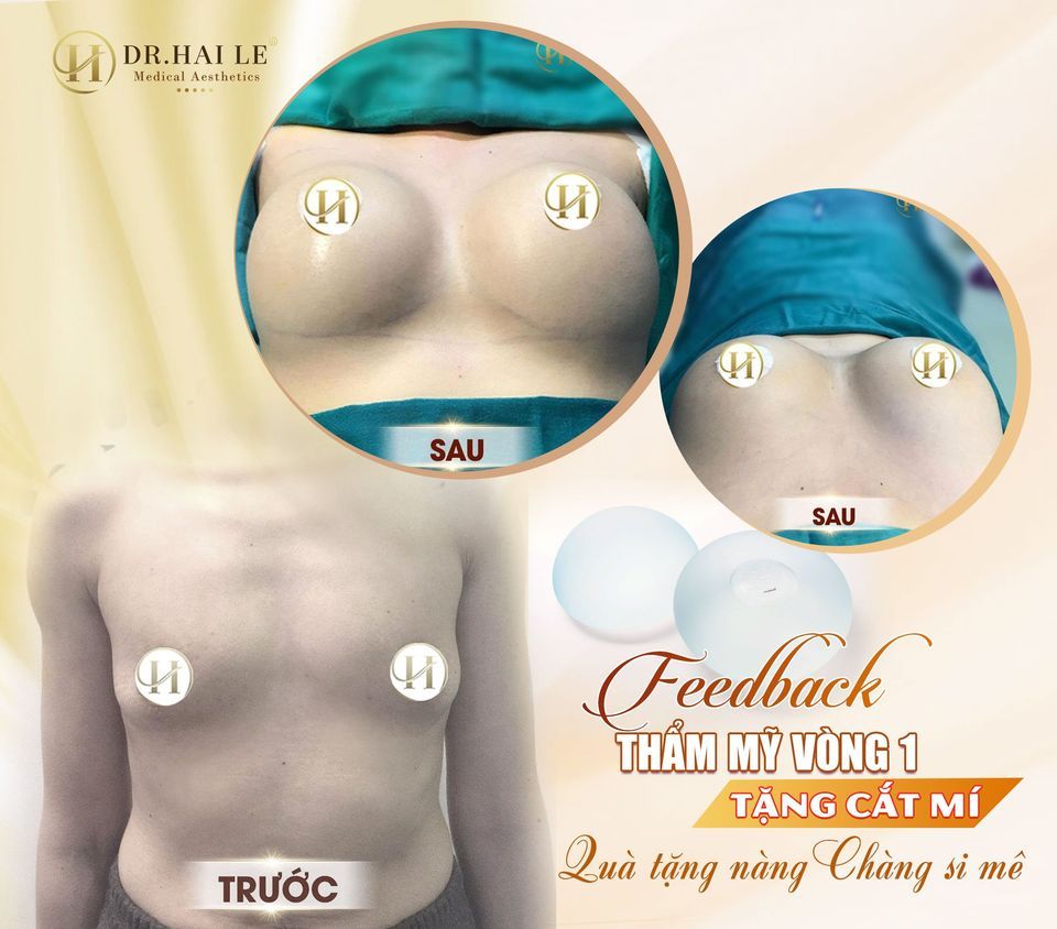 Nhìn ngực đẹp to tròn, căng mướt mịn thế kia cứ bị thích í, công nhận phụ nữ có tí ngực vào nhìn gợi cảm hẳn, mặc gì cũng đẹp