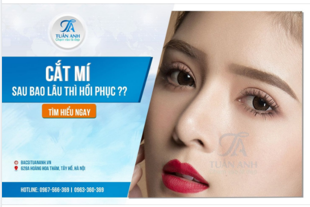NHỮNG ĐIỀU BẠN CẦN BIẾT VỀ CẮT MÍ HỒI PHỤC SAU BAO LÂU